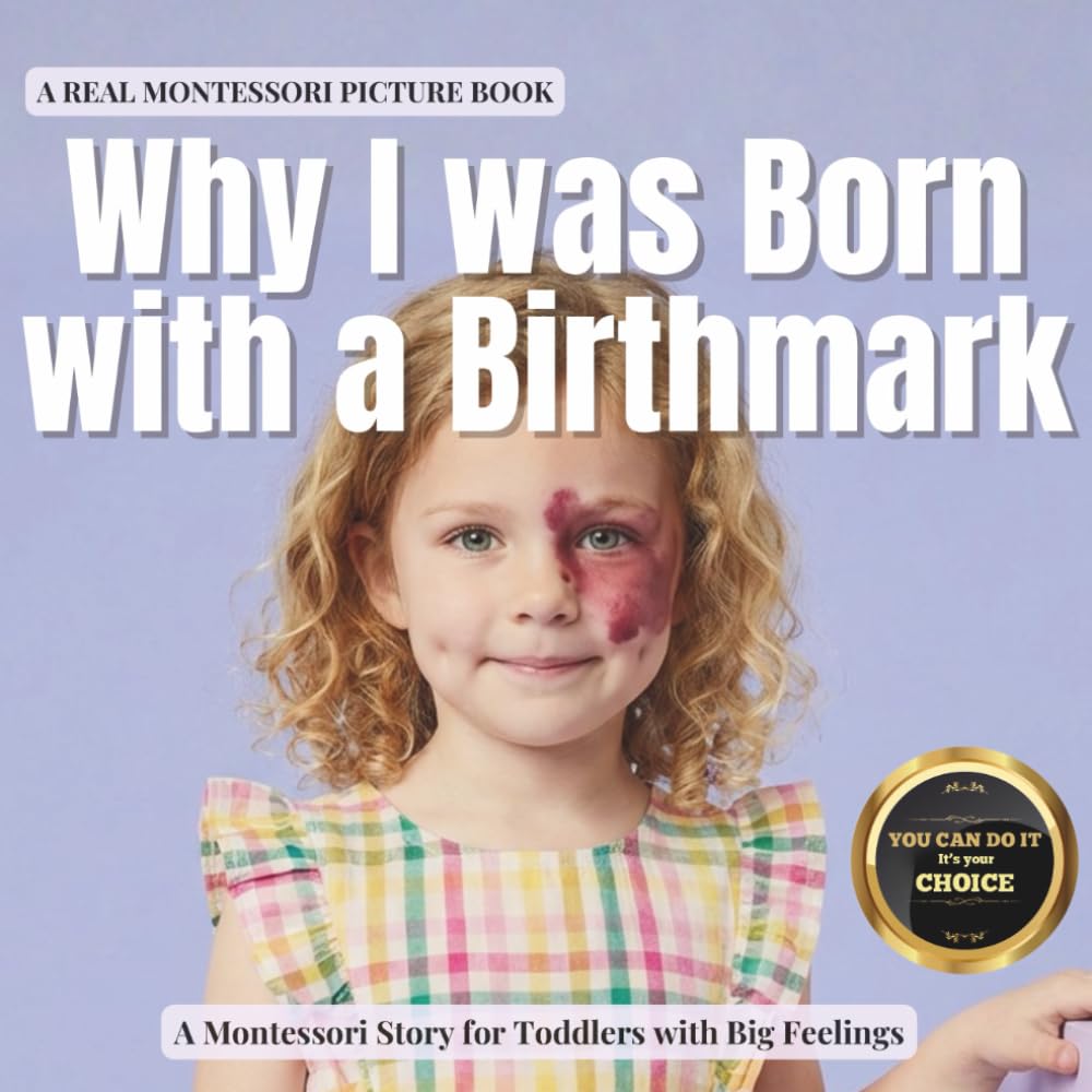 Cover of Why I was Born with a Birthmark
